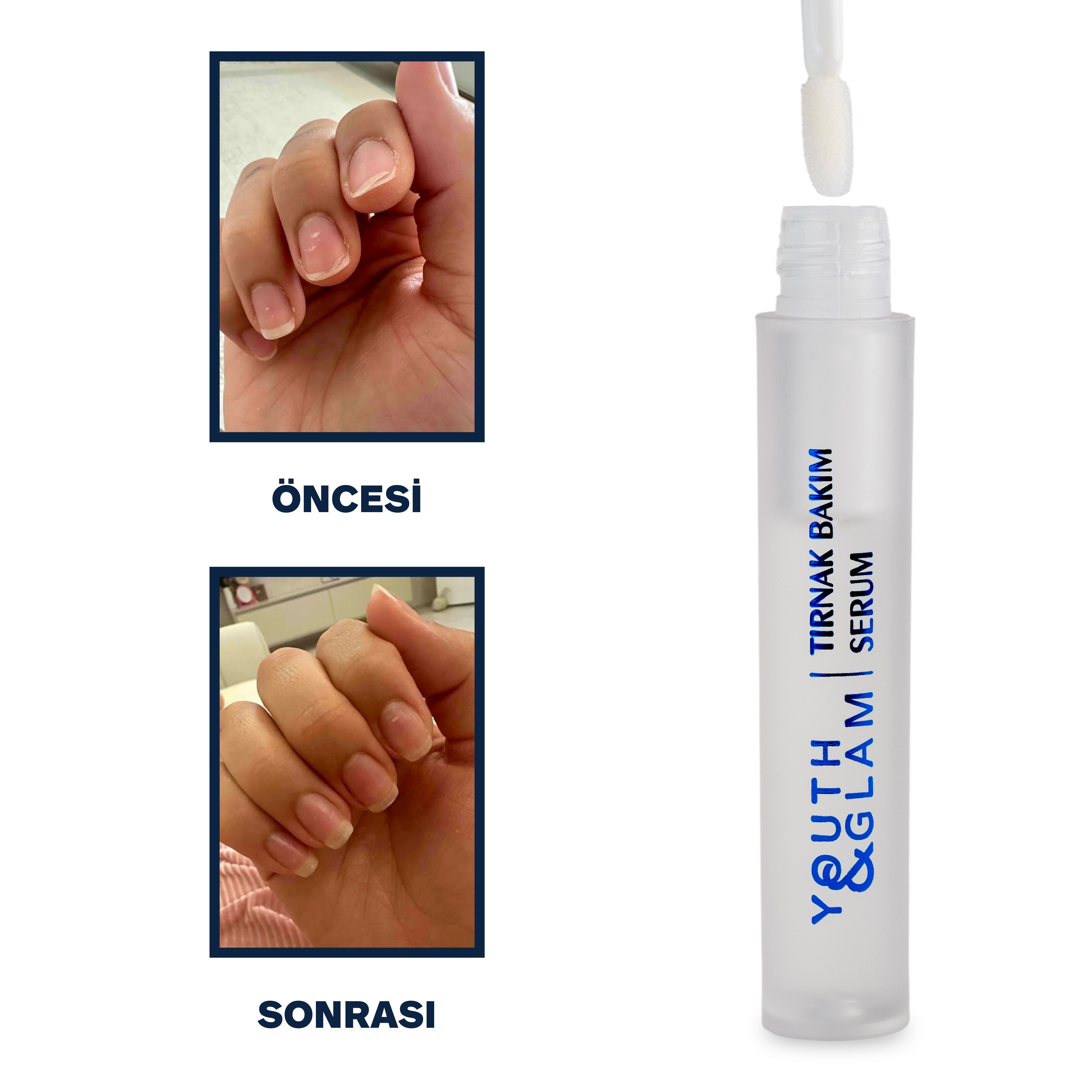 TIRNAK BESLEYİCİ VE GÜÇLENDİRİCİ SERUM